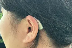 三分之一老人有听力损失，延迟干预致跌倒、老年痴呆风险倍增图片