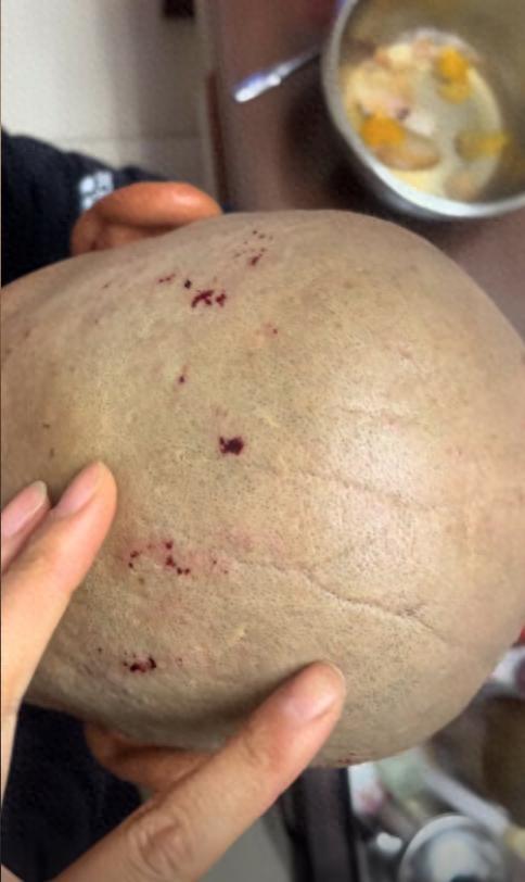 大爷花10元剃头后满头伤口不忍追责