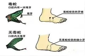 九旬老太被蛇咬 喝药酒“解毒”险断臂图片