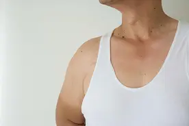 皮肤长红痣，除了肝病，还可能与这3个因素有关图片