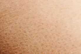 痒！痒！痒！最近重庆很多人直呼太难受，网友：痒得停不下来图片