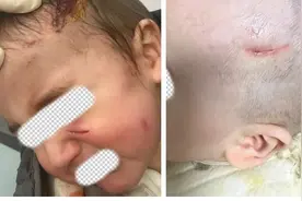 沪上1岁混血萌娃突遭宠物狗扑咬！头面部多处撕裂紧急送医图片