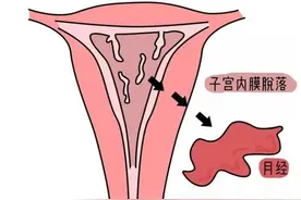 【汤医科普】从月经看女性生理的自然变迁图片
