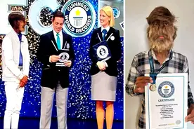 18岁印度少年获得“最毛脸”吉尼斯纪录，脸上95%覆盖毛发，患罕见病多毛症图片