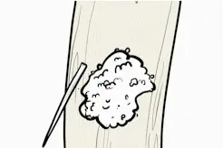 29岁小伙因鱼刺卡喉不幸去世！医生痛心提醒：这些土方法会要命！图片