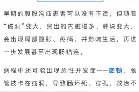 更青睐小儿老人的“小肠气”不可拖延治疗！图片
