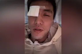 在训练中遭遇眼部重伤，郭艾伦：以后可能打不了篮球了图片
