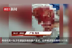 女子剖腹产后纱布遗留体内15个月，医院：已取出，双方正协商处理图片