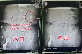 提醒：长期不爱喝水，后果很严重！图片