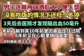 男子连喝两场酒后大小便失禁，3天后去医院才发现脑出血50毫升图片