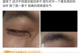 知名篮球运动员郭艾伦自曝眼部受伤 俱乐部：昨日训练中受伤，在场球员都很自责图片