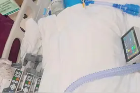 山东28岁小伙突患肝衰竭，每天需3000毫升血救治不限血型，当地正组织献血应急图片