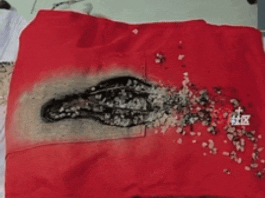 女子连续3天打麻将，双腿长出“蟒蛇纹”！电暖麻将桌：这锅我不背