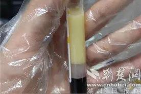 男子狂吃小龙虾喝啤酒 不料抽出“牛奶血”图片