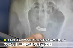 15岁男孩腹痛尿频，医生从下体拿出一串……差点毁了一生！图片