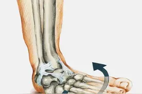 脚踝扭伤怎么办？这些治疗与康复手法请收藏→图片