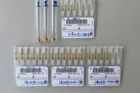 发现1例！极为罕见！图片