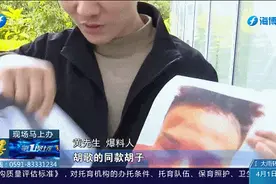 男子做明星同款植发“翻车”，还留下后遗症？图片