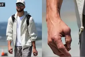 巴克利谈库里肿胀的拇指：这是真的吗？那看起来都不像人类的手了图片