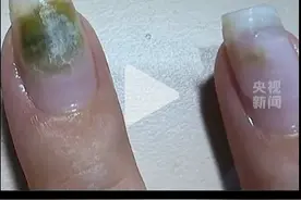做美甲竟感染HPV，提醒：隐患多，别频繁做图片