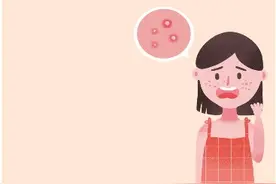 从“浪漫玫瑰”到肌肤烦恼图片