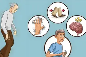 世界帕金森病日｜易混淆！帕金森病≠帕金森综合征，预防帕金森做好这5点图片