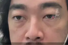 网友吐槽南航飞机餐4个馒头1片白菜外加一包小咸菜，客服：不同航线不一样 ，白菜是防止馒头烤糊图片