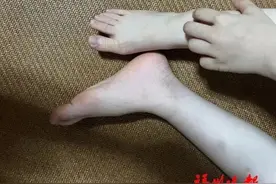 一觉醒来，身上密密麻麻都是红疹，近期高发，很多人中招！罪魁祸首是螨虫……赶紧自查图片