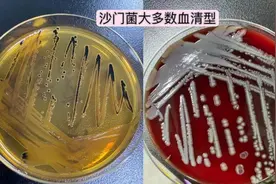 孩子发热、呕吐、拉肚子，元凶竟是“沙门氏菌”！图片