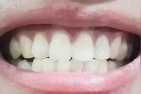 三个动作+一个食谱？比吃药都有用的专家私藏的补肾小方！图片