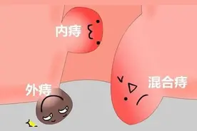 夏未央，秋已到，防“痔”复发正当时图片