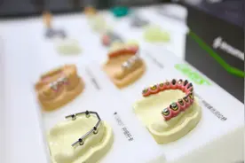 拔牙后种牙听起来更简单，为何要费力保留一颗坏掉的牙？九院专家释疑图片