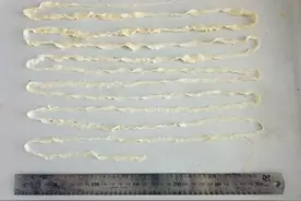 吃了这种肉，有人体内长出4米长的虫子？预防方法→图片