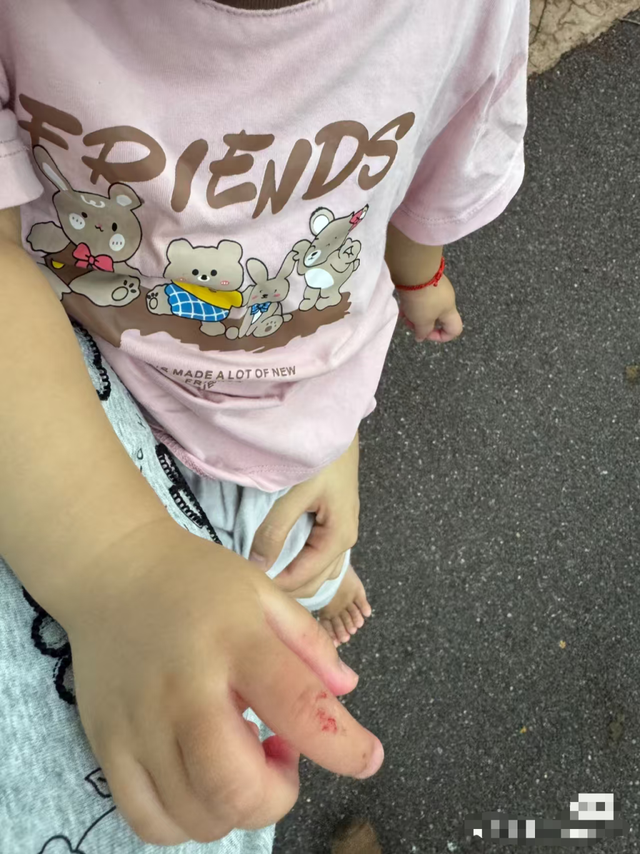 广州知名景区黑猩猩丢石块，砸伤1岁多幼童！官方回应