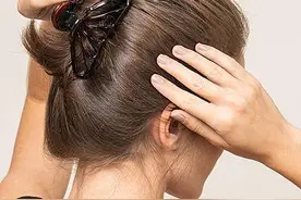 @戴发夹的女性，医生紧急提醒，这种发夹骑车的时候不要戴！图片