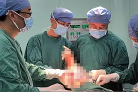 男子关节畸形下肢缩短近10厘米，矫形技术帮患者延长小腿图片