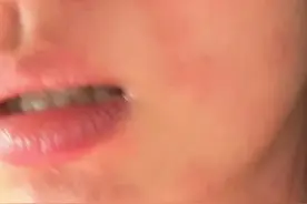 “痒到崩溃”！女演员晒照求助图片