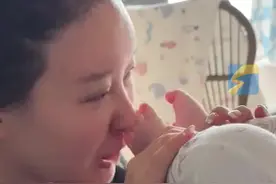 34岁女演员因爱闻自己4个月宝宝的脚丫 导致眼睛感染肿胀 无法睁眼图片