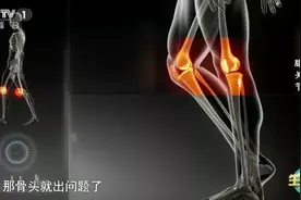 一亿人的膝盖在“哭泣”！中医支招，有效缓解疼痛图片