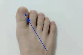 动不动就发火，不一定是脾气差，可能是这个地方出问题了！图片