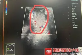 轻轻一碰疼痛难忍！13岁男孩确诊，这种病并非女性专属图片