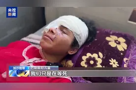 人间悲剧在加沙 受伤最深是儿童图片