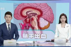 35岁程序员长期熬夜脑干出血 在ICU一共待了28天 现在已经恢复了70%