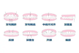 全国爱牙日：你的牙齿，有必要矫正吗？图片