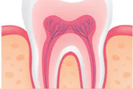 牙疼非小病，疼起来真要命图片