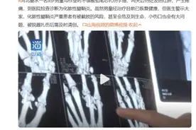孩子被铅笔扎伤，会有毒吗？要不要打破伤风？图片