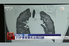 警示！防晒喷雾使用不当，1小时可致“白肺”，而且……图片