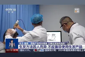 拒绝智商税！充斥网络的生发偏方、防脱产品到底靠不靠谱？图片