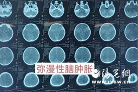 10岁娃车祸后昏迷三月 西安市红会医院神外SCS技术促醒图片