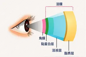眼睛 “迎风流泪”？千万别把它当小问题！图片